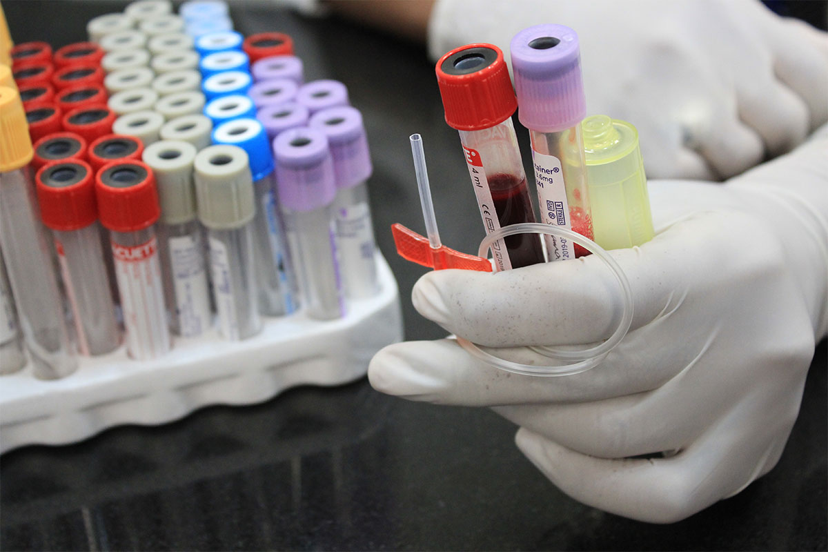 Blood sample collection by trained phlebotomist for laboratory testing at Liaquat National Hospital