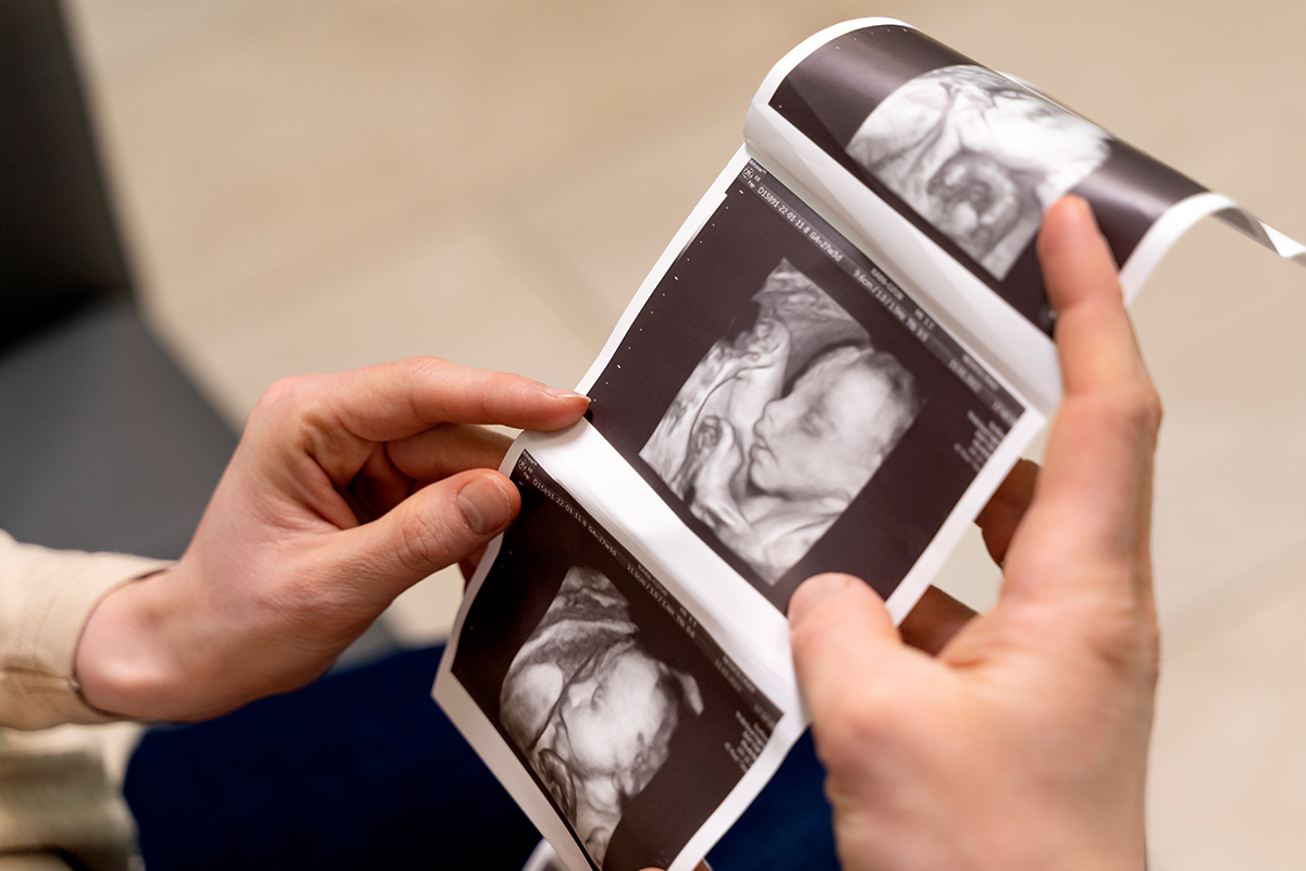 4d ultrasound service