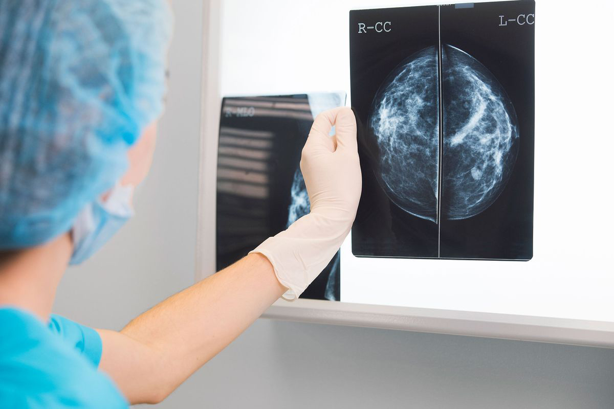 breast ultrasound price