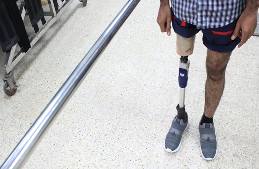 Prosthetic Leg - Below-Knee Prosthetics - Prosthetic Orthotic